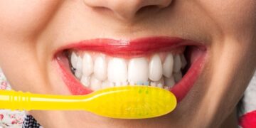Evde diş beyazlatma hakkında dönüşü olmayan 4 hatta