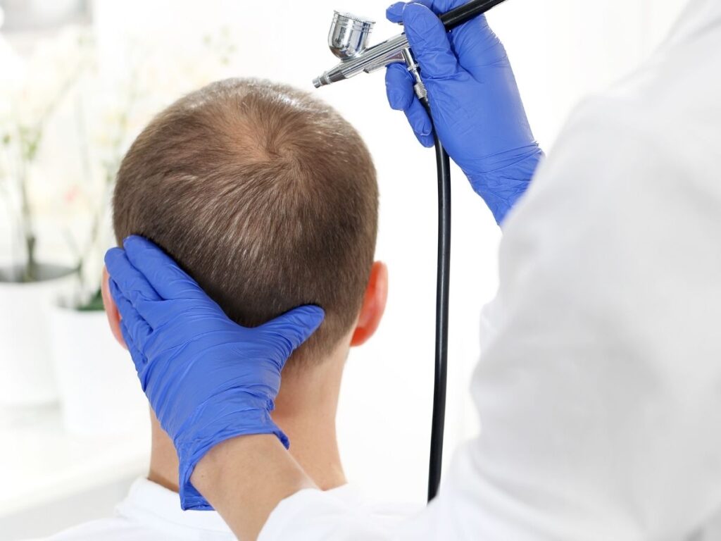 Genetik saç dökülmesinde çeşitli ilaçlar ve cerrahi kullanılan yöntemler arasında bulunuyor. 